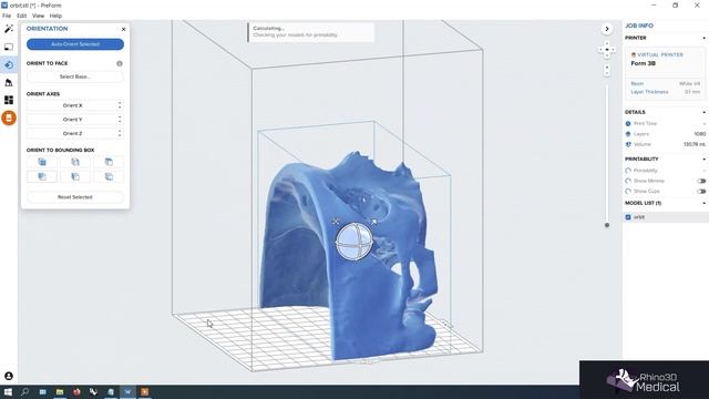 3D print Rhino3DMedical model with Formlabs смотреть онлайн