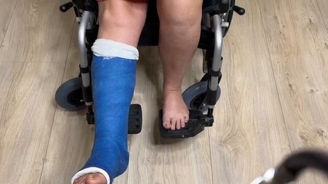 ПЕРЕЛОМ ЛОДЫЖКИ.ЧТО ДЕЛАТЬ?ПОЛИМЕРНЫЙ ГИПС.ДЕЛЮСЬ ОПЫТОМ смотреть онлайн