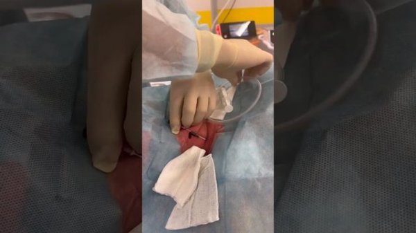 Центральный венозный катетер. Отработка навыка.