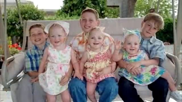 Этих сиамских близнецов бросили в роддоме! Вот что с ними стало спустя 19 лет! смотреть онлайн