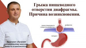 Грыжа пищеводного отверстия диафрагмы. Причина возникновения.