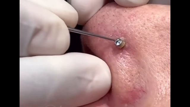 Чистка пирсинга / пирсинг / piercing Infection / piercing cleaning / piercing смотреть онлайн