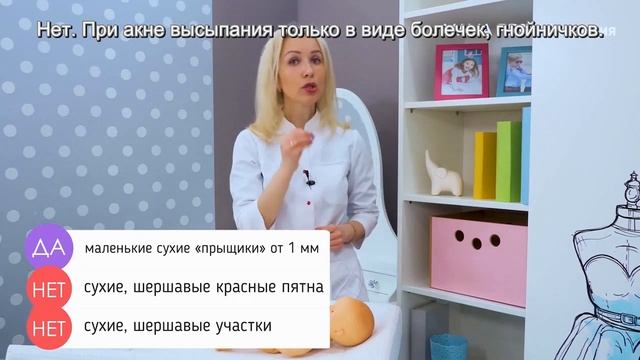 Акне у новорожденных