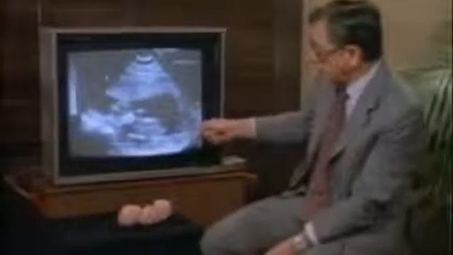 Безмолвный крик. Что происходит с ребенком во время аборта смотреть онлайн