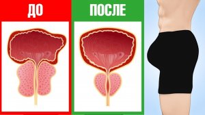 Упражнения для повышения мужской силы и потенции. Упражнения для простаты