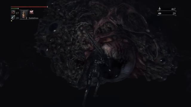 Bloodborne - Mother Brain location after the drop & fight смотреть онлайн