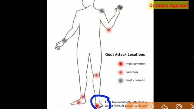 Kidney function test (KFT) रिपोर्ट देखना सीखे || किडनी की जाँच || कब कराए KFT смотреть онлайн