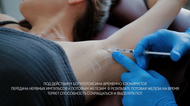 Гипергидроз смотреть онлайн