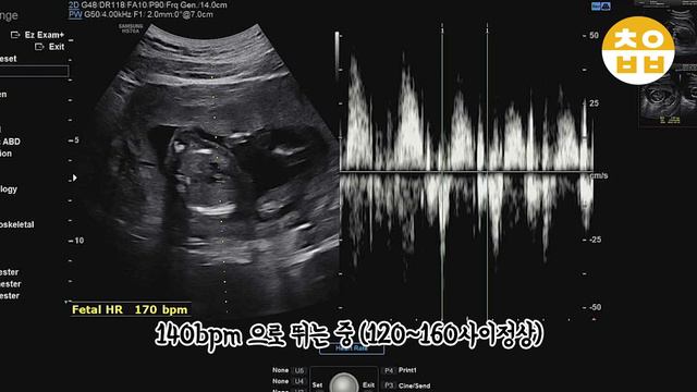 SUB)17주 정기검진｜정기검진, 2차기형아검사, 임신17주초음파, 임신배크기🧡🧡 смотреть онлайн