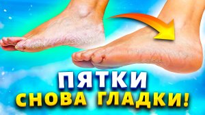 Нежные пяточки цвета «поросят».  Смешала 2 ингредиента  и убрала  натоптыши, сухие мозоли, трещины