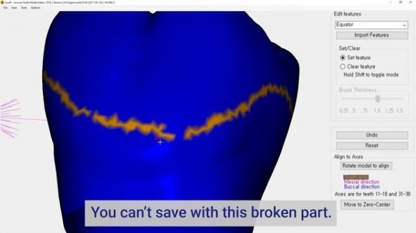 How to Create a Tooth Library in exocad
