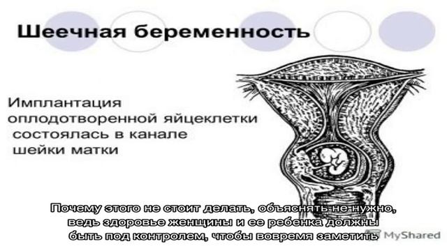 Шейка матки при беременности: нормы длины по неделям в таблице и причины отклонений