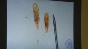 Про Описторх (двуустка кошачья) и Описторхоз