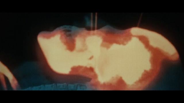 Logan Easter Eggs Revealed! смотреть онлайн