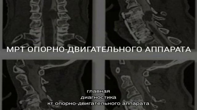 КТ-фистулография в Москве смотреть онлайн