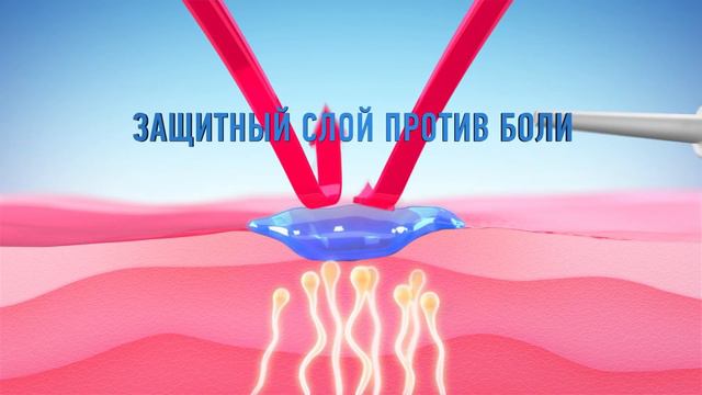 Anaftin 15s RU смотреть онлайн