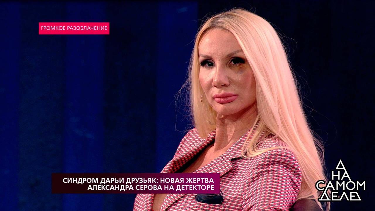 "Это следы нашего бурного секса", - светская львиц.... На самом деле. Фрагмент выпуска от 15.10.2018 смотреть онлайн