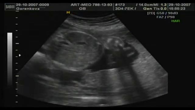 4D Узи - Видео. смотреть онлайн