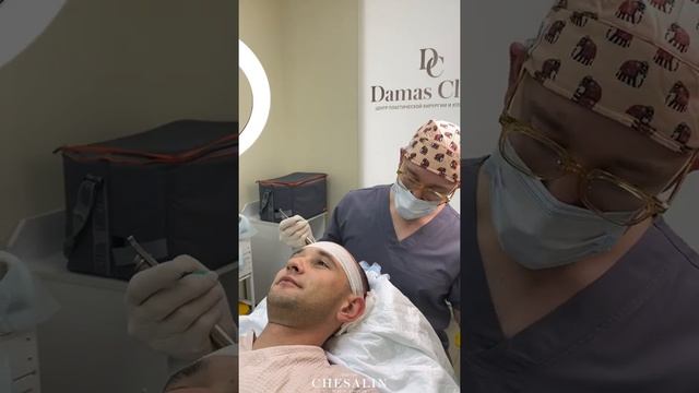 Пересадка волос в височно-лобную зону! смотреть онлайн