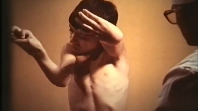 Торсионный спазм, дистонический гиперкинез © Torsion Spasm, Dystonic Hyperkinesis