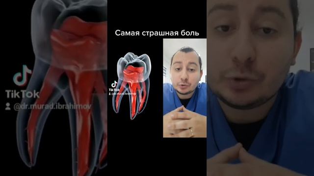 Самая страшная боль😱 #стоматолог #зубы #дантист #зубнойврач #dişhekimi #diş #баку #азербайджан #нер смотреть онлайн