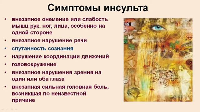 Диагностика инсульта.Видео-лекция