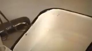 методика измерения центрального венозного давления