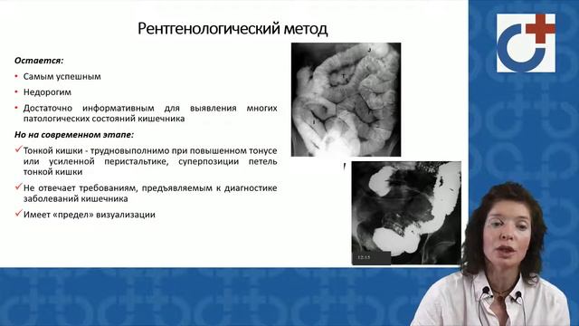 Современная лучевая диагностика болезней кишечника смотреть онлайн