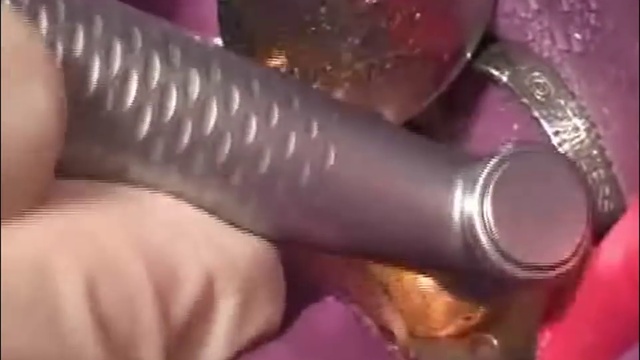 Наращивание культи зуба смотреть онлайн
