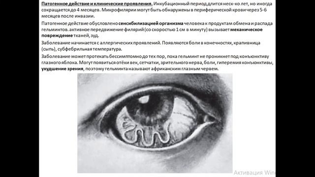 Лоа лоа (Loa Loa)