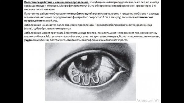 Лоа лоа (Loa loa)