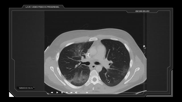 COVID Pandemic - Doctor Mike Hansen's PREDICTION About COVID