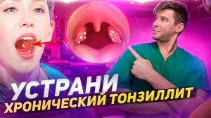 Хронический тонзиллит. Методы врачебного лечения и когда нужна операция. Часть 2.