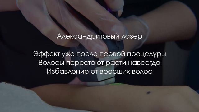 Лазерная эпиляция на александритовом лазере Deka смотреть онлайн