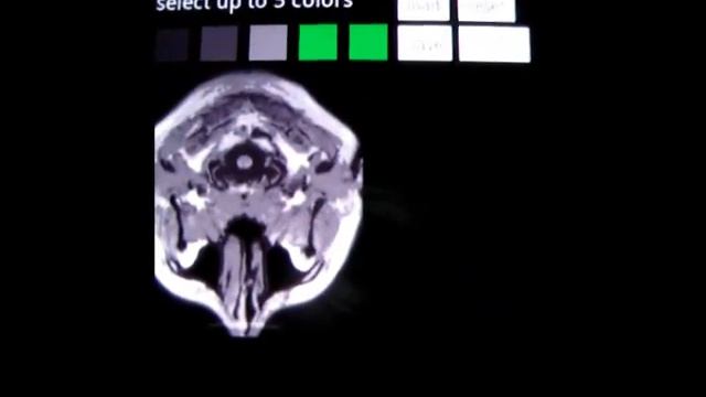 Medical Image Display смотреть онлайн