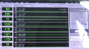 Диагностика ДМРВ Приора