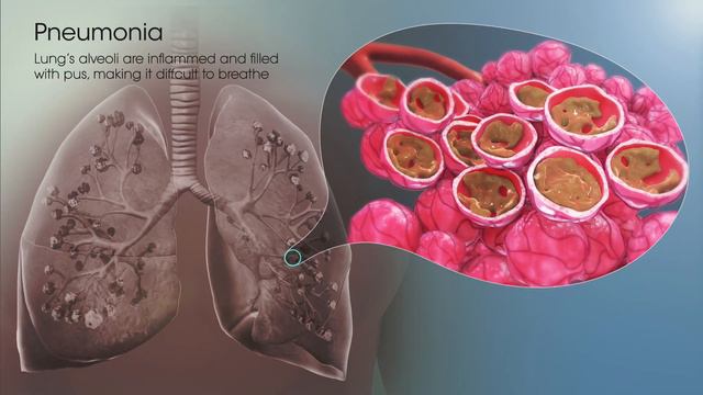 Air Pollution 101 - Part 1 | (Silent Killer) смотреть онлайн