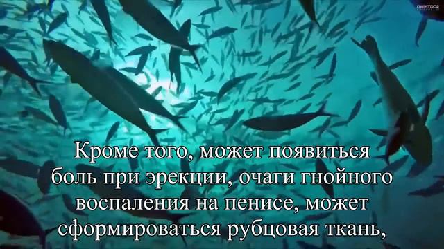 Уролог назвал новую опасность для мужчин — Статья смотреть онлайн