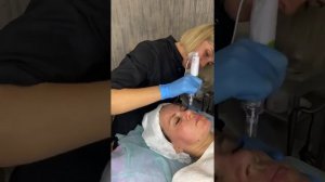 Жидкий лазер - уход за лицом, сочетание пилинга PRX-T33 и фракционной мезотерапии