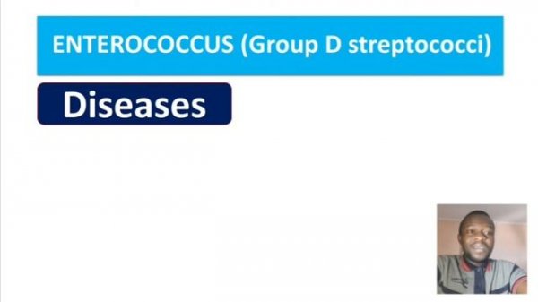 Group D Streptococcus (Enterococcus)