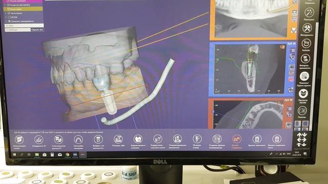 Стоматология "Сабина" Екатеринбург ул. Старых большевиков д.3 смотреть онлайн