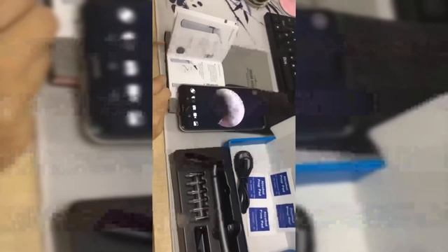 Рейтинг ТОП 5: Лучшие отоскопы с АлиЭкспресс | Медицинский Эндоскоп (видеоскоп) для чистки ушей