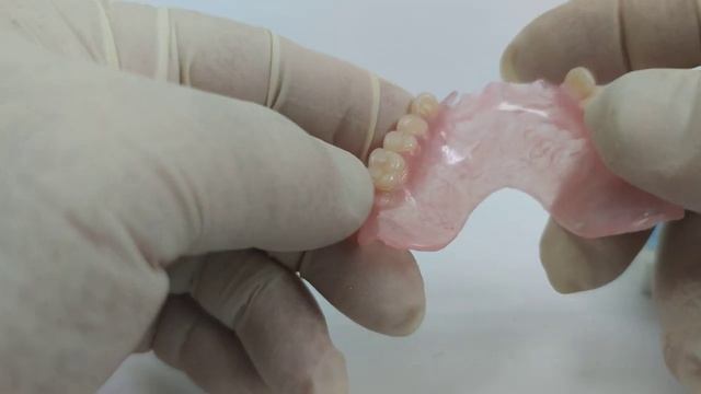 Зубной протез (частично съёмный)