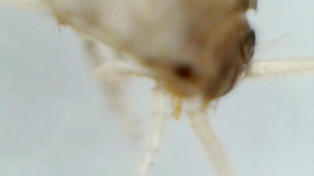 Чешуйница под микроскопом смотреть онлайн