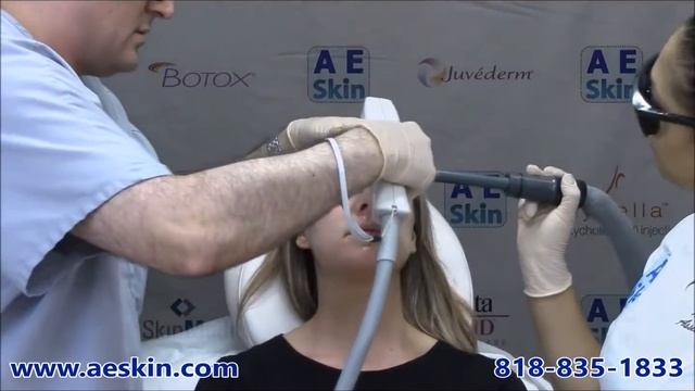 Forever Young BBL IPL Photofacial Demonstration 20 - A E Skin - Encino, CA - 818-835-1833 смотреть онлайн