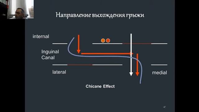 Факультетская хирургия №11 "Грыжи передней брюшной стенки и их осложнения. " смотреть онлайн