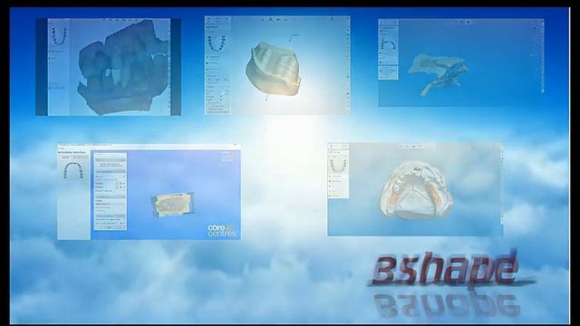 dental laboratory with digital 3D scanner technology смотреть онлайн