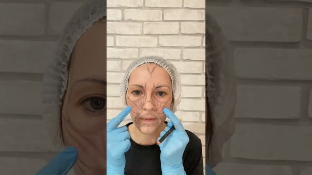 Анатомия мышц лица для массажа.Живой пример. смотреть онлайн