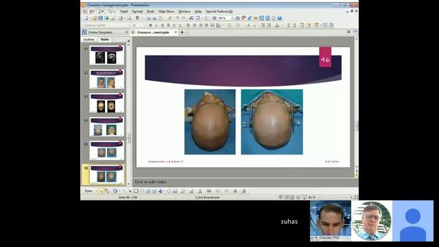 Dr. Udayakumaran & Dr. Subhash: Craniofacial Dysostosis Syndromes: Sequencing Treatment смотреть онлайн