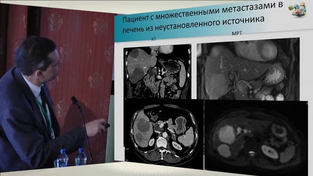 В.Е. Синицын. "Опухоли без выявленного первичного очага" смотреть онлайн